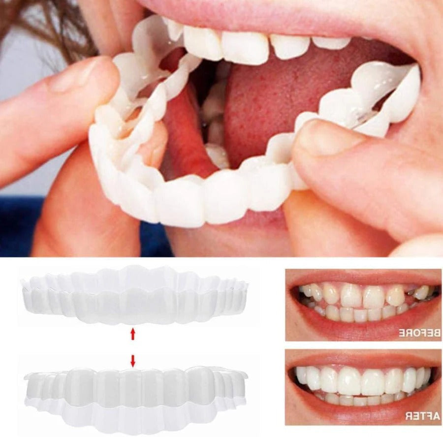 Dental Veneer Kit with Upper and Lower Covers 5