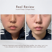 GLIZM™ Collagen Mask 5