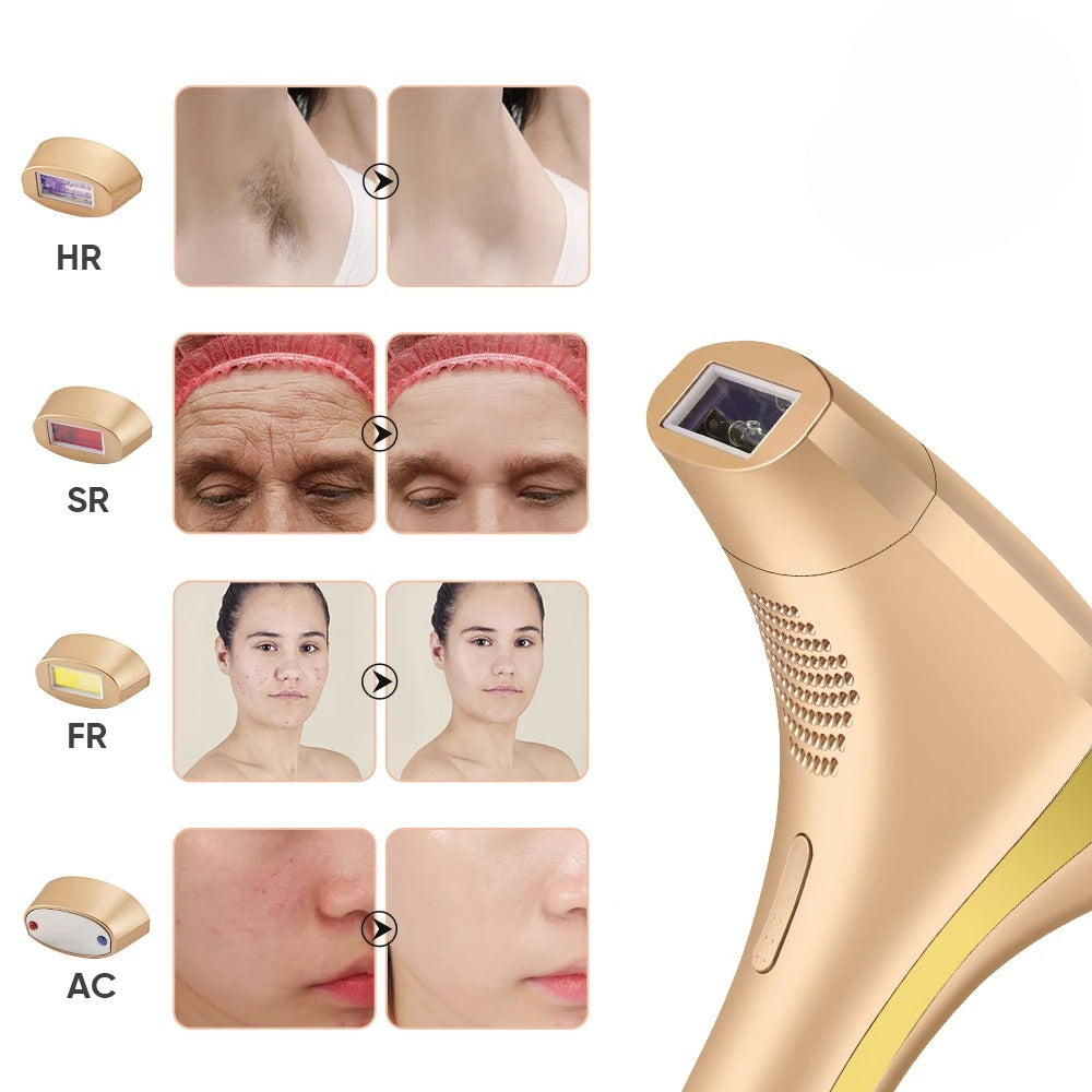 FrostBeam 4-i-1 islaser hårfjernelsessystem til ansigt og krop, permanent IPL, smertefri fotoepilator, opgradering 2026