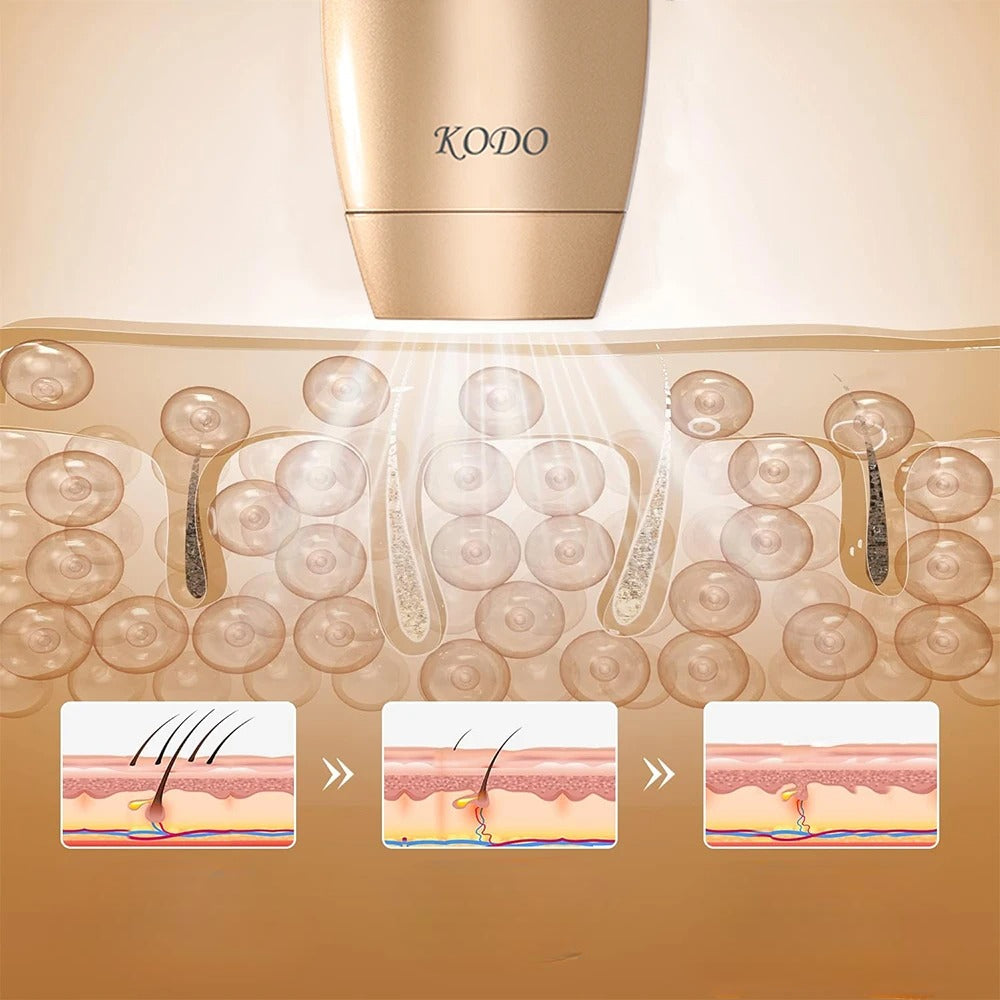 KODO_2026_High-end_customization_ice_Laser_Hair_removal_Laser_Epilator_Permanent_IPL_Painless_Photoepilator_4_in_1_face_and_body_5.jpg
