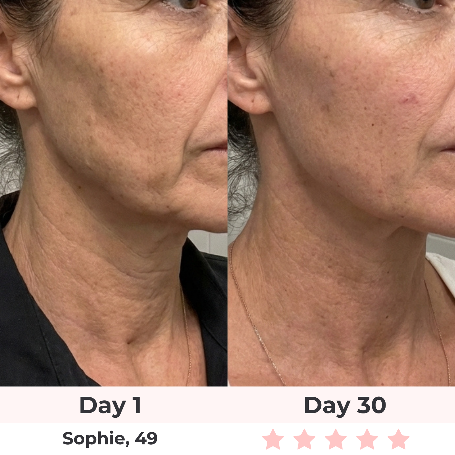 Lux Cove 7-in-1 LED Facial Sculptor 3