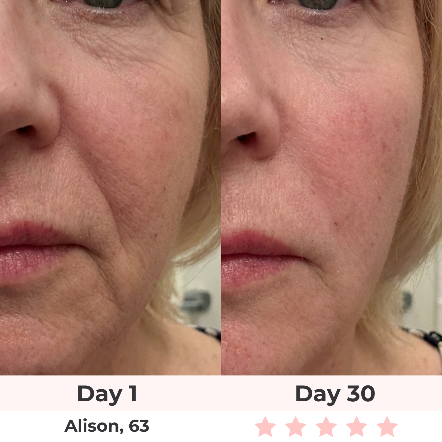 Lux Cove 7-in-1 LED Facial Sculptor 5