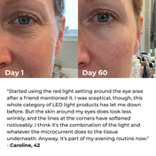 Lux Cove 7-in-1 LED Facial Sculptor 7